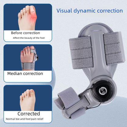 Upgraded Adjustable Bunion Corrector - SkyeDragon Gifts